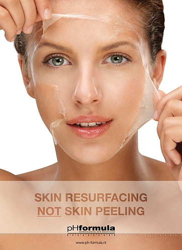 peeling-resurfacing_HR